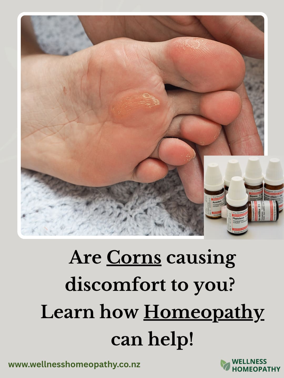 Are Corns causing discomfort to you? Learn how Homeopathy can help!
